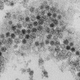 Enterovirus D68, a cousin of the polio virus, is suspected of causing acute flaccid myelitis.